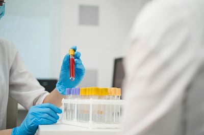Solutions for When the Blood Sample Clots Too Quickly