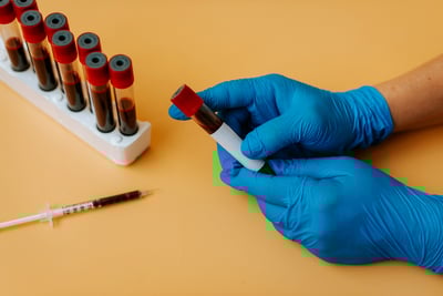 Managing Needle Stick Injuries in Blood Collection