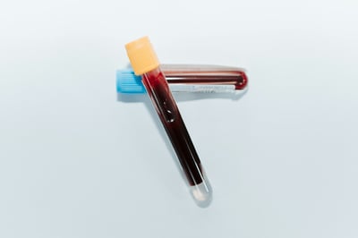 Addressing Language Barriers During Blood Collection